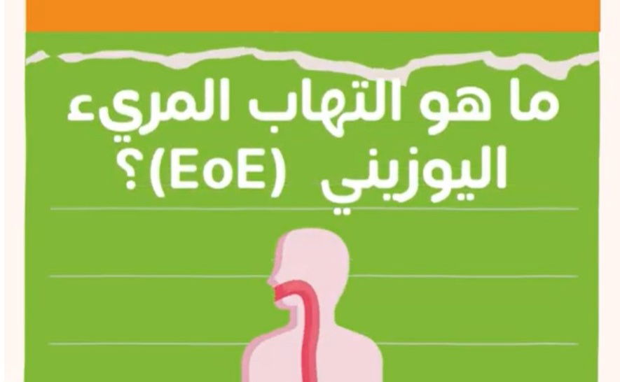 ما هو التهاب المريء اليوزيني (EoE) ؟