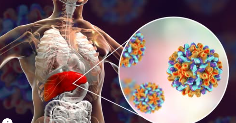 توصيات منظمة الصحة العالمية لمنع الإصابة بعدوى الكبد الفيروسي المزمن
